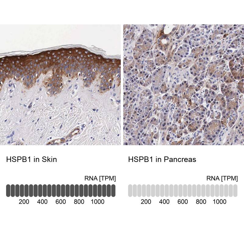 HSP27 Antibody - BSA Free Immunohistochemistry-Paraffin: HSP27 Antibody - BSA Free [NBP1-89666]