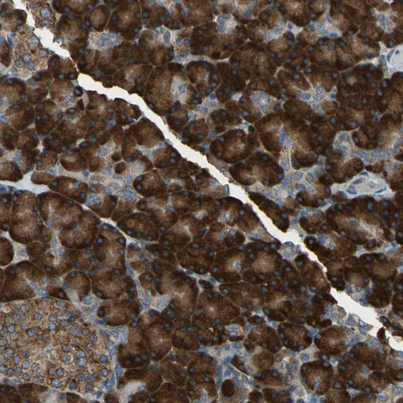 HRD1 Antibody - BSA Free Immunohistochemistry-Paraffin: HRD1 Antibody - BSA Free [NBP1-89667]