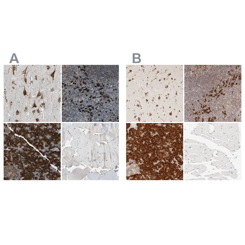 HRD1 Antibody - BSA Free Immunohistochemistry-Paraffin: HRD1 Antibody - BSA Free [NBP1-89667]