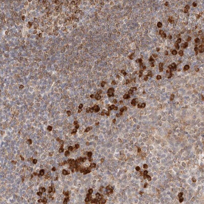 HRD1 Antibody - BSA Free Immunohistochemistry-Paraffin: HRD1 Antibody - BSA Free [NBP1-89668]