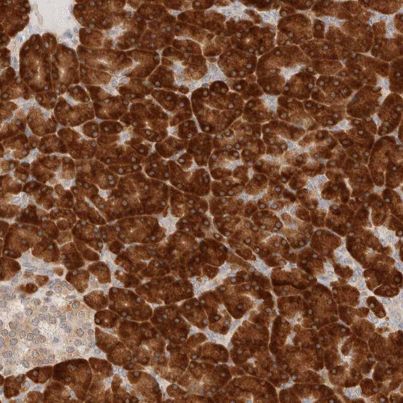 HRD1 Antibody - BSA Free Immunohistochemistry-Paraffin: HRD1 Antibody - BSA Free [NBP1-89668]