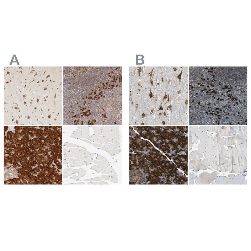HRD1 Antibody - BSA Free Immunohistochemistry-Paraffin: HRD1 Antibody - BSA Free [NBP1-89668]
