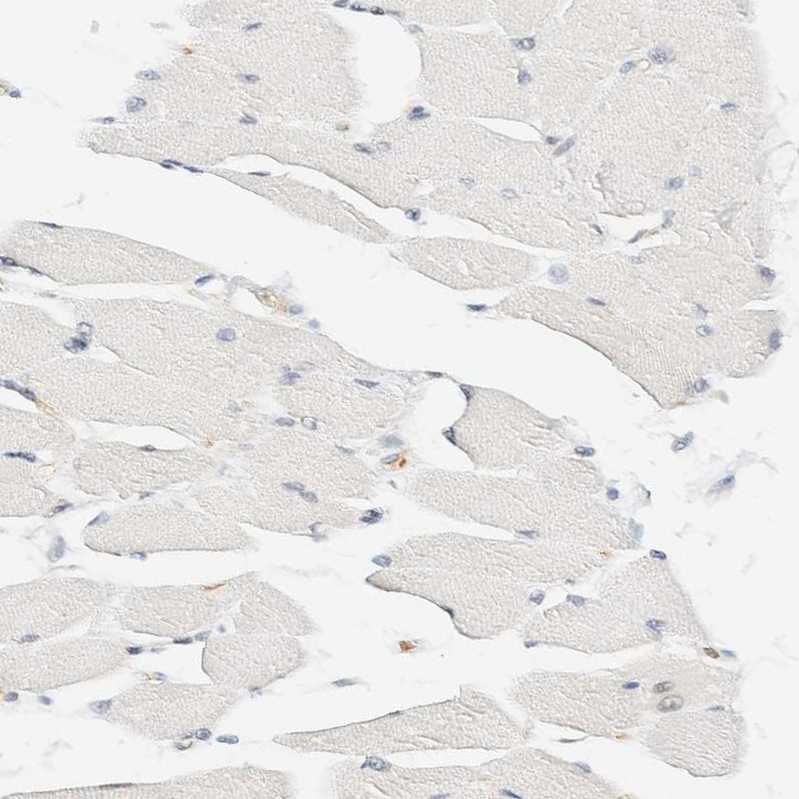 HRD1 Antibody - BSA Free Immunohistochemistry-Paraffin: HRD1 Antibody - BSA Free [NBP1-89668]