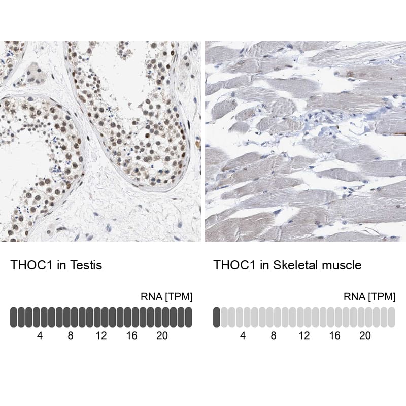 hHpr1-p84-Thoc1 Antibody - BSA Free Immunohistochemistry-Paraffin: hHpr1-p84-Thoc1 Antibody - BSA Free [NBP1-89670]