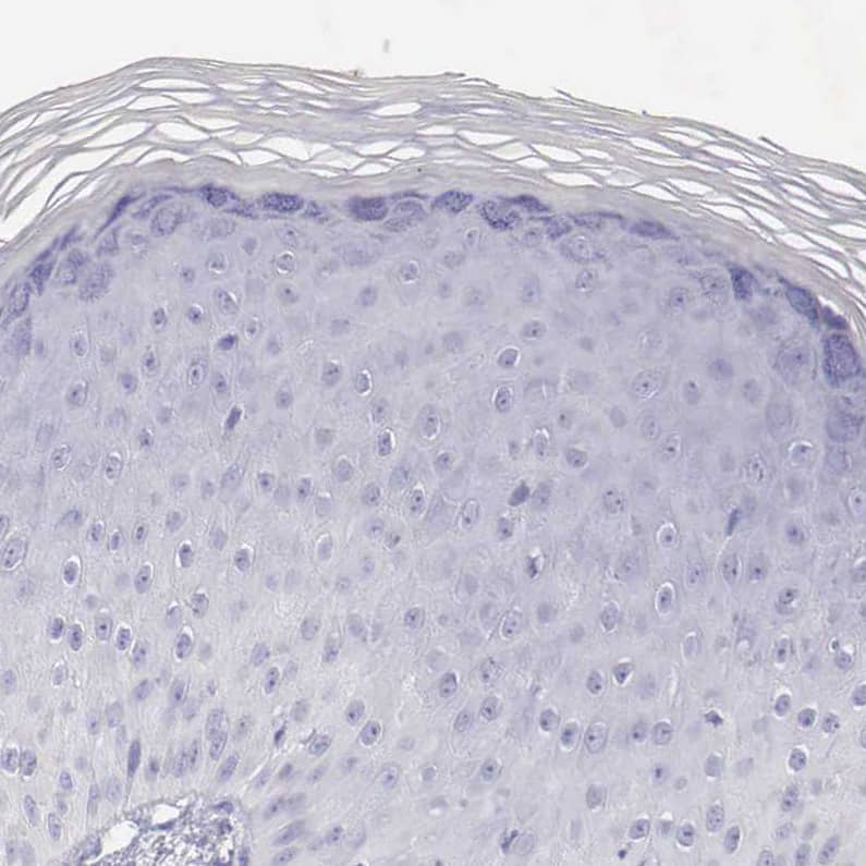 VAP-1/AOC3 Antibody - BSA Free Immunohistochemistry-Paraffin: VAP-1/AOC3 Antibody - BSA Free [NBP1-89671]