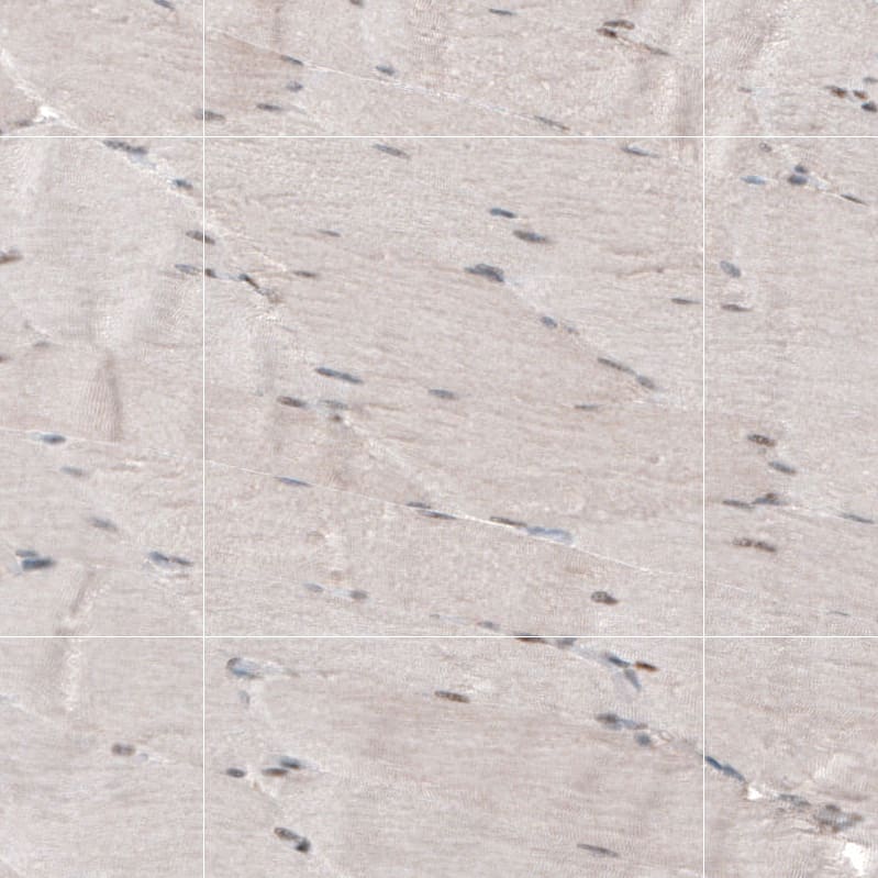 HP1 alpha Antibody - BSA Free Immunohistochemistry-Paraffin: HP1 alpha Antibody - BSA Free [NBP1-89672]