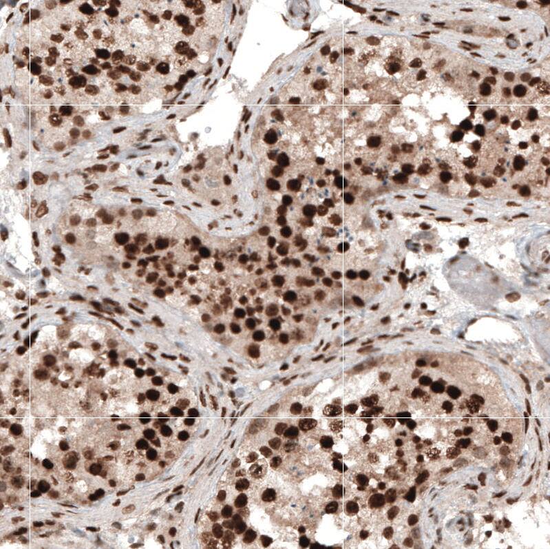 HP1 alpha Antibody - BSA Free Immunohistochemistry-Paraffin: HP1 alpha Antibody - BSA Free [NBP1-89672]