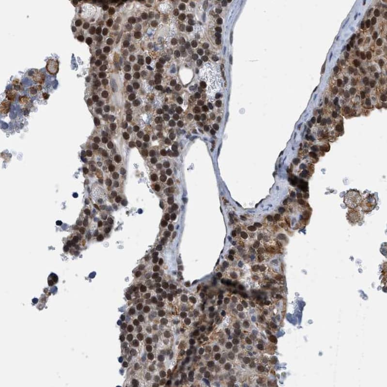 HP1 alpha Antibody - BSA Free Immunohistochemistry-Paraffin: HP1 alpha Antibody - BSA Free [NBP1-89672]
