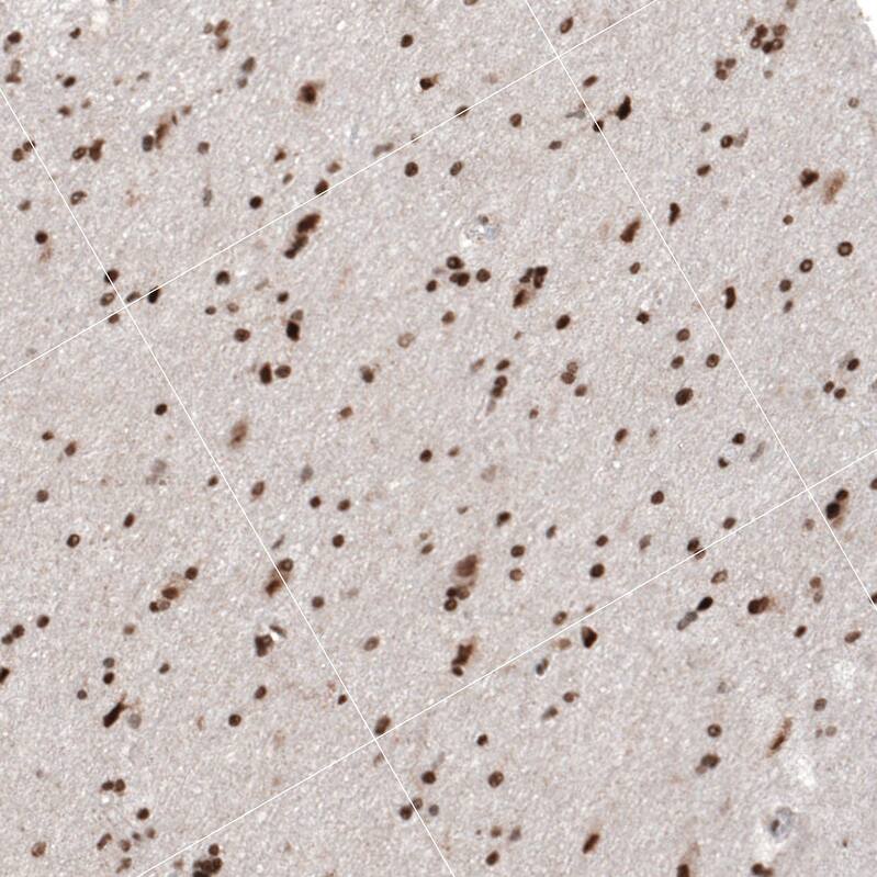 HP1 alpha Antibody - BSA Free Immunohistochemistry-Paraffin: HP1 alpha Antibody - BSA Free [NBP1-89672]