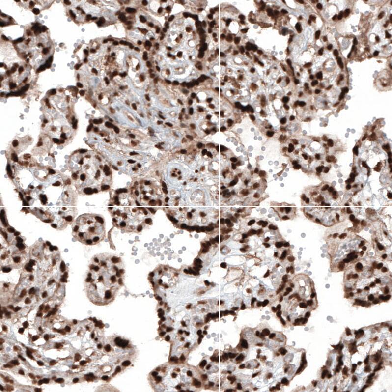 HP1 alpha Antibody - BSA Free Immunohistochemistry-Paraffin: HP1 alpha Antibody - BSA Free [NBP1-89672]