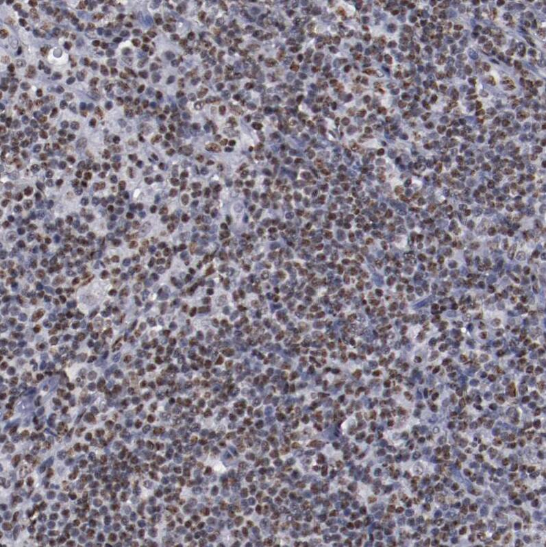 hnRNP A2B1 Antibody - BSA Free Immunohistochemistry-Paraffin: hnRNP A2B1 Antibody - BSA Free [NBP1-89675]