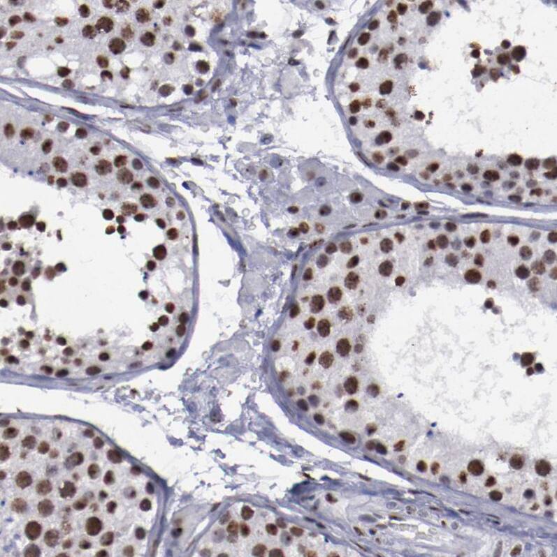 hnRNP A2B1 Antibody - BSA Free Immunohistochemistry-Paraffin: hnRNP A2B1 Antibody - BSA Free [NBP1-89675]
