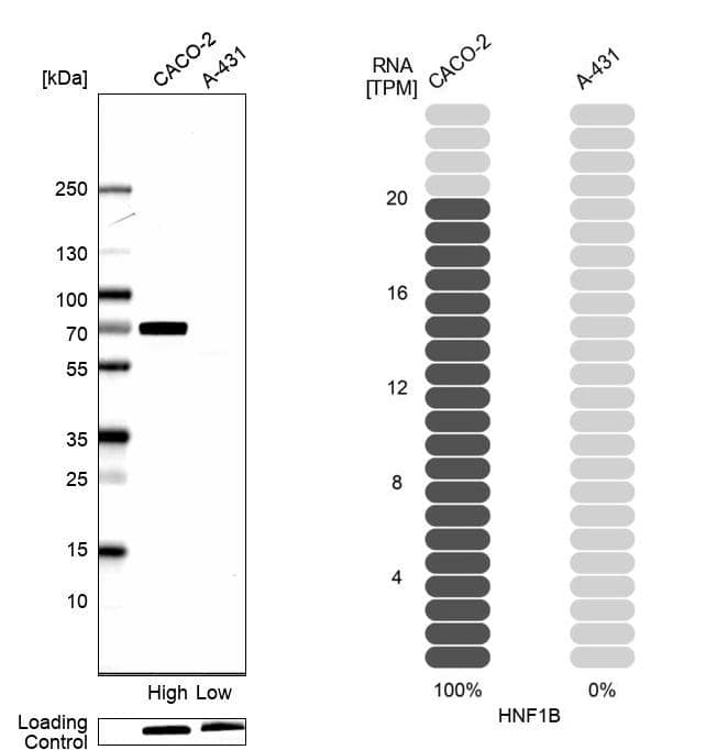 TCF-2/HNF-1 beta Antibody - BSA Free Western Blot: TCF-2/HNF-1 beta Antibody - BSA Free [NBP1-89680]