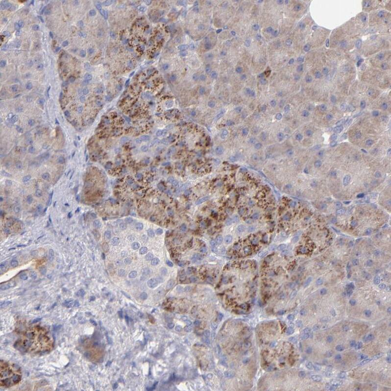 MDA5 Antibody - BSA Free Immunohistochemistry-Paraffin: MDA5 Antibody - BSA Free [NBP1-89685]