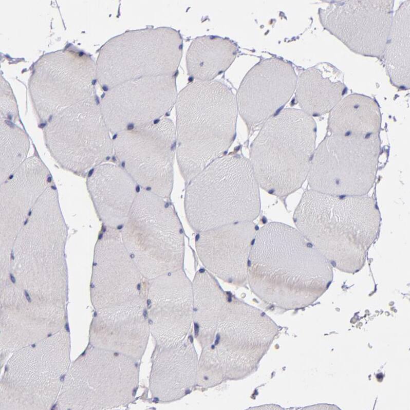 MDA5 Antibody - BSA Free Immunohistochemistry-Paraffin: MDA5 Antibody - BSA Free [NBP1-89685]