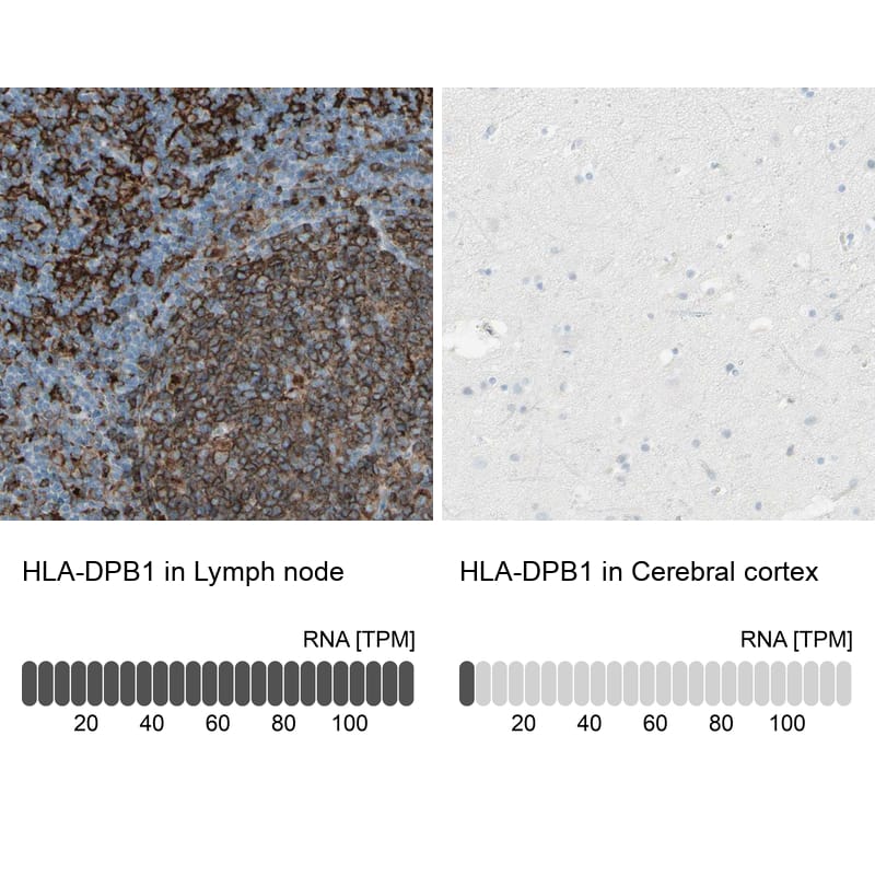 HLA DPB1 Antibody - BSA Free Immunohistochemistry-Paraffin: HLA DPB1 Antibody - BSA Free [NBP1-89688]