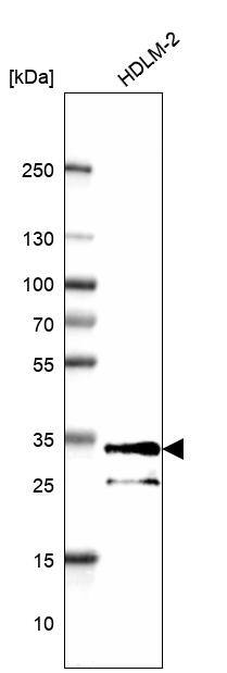 HLA DPB1 Antibody - BSA Free Western Blot: HLA DPB1 Antibody - BSA Free [NBP1-89688]