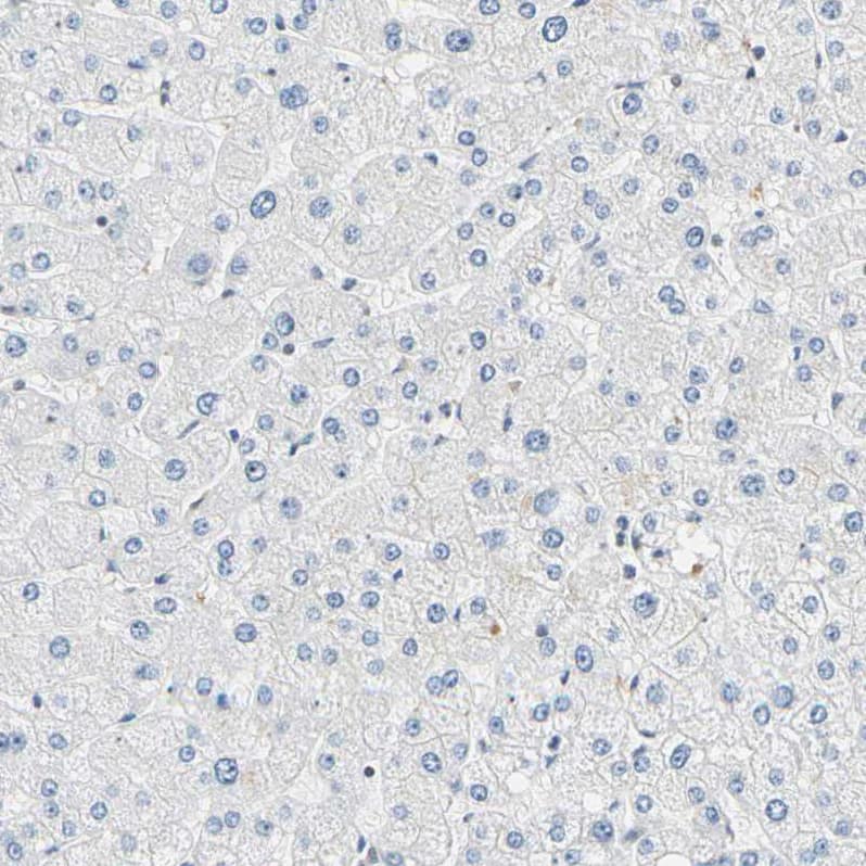 SMARCA5/SNF2H Antibody - BSA Free Immunohistochemistry-Paraffin: SMARCA5/SNF2H Antibody - BSA Free [NBP1-89692]