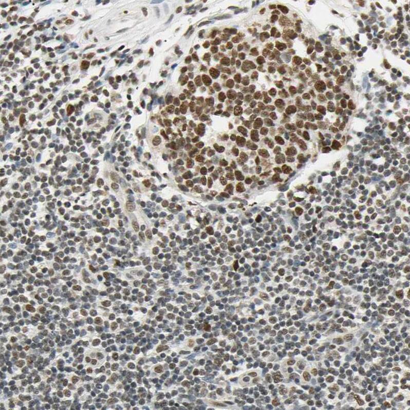 SMARCA5/SNF2H Antibody - BSA Free Immunohistochemistry-Paraffin: SMARCA5/SNF2H Antibody - BSA Free [NBP1-89692]