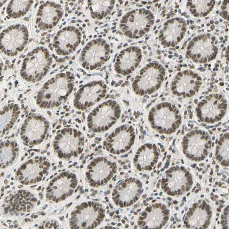 SMARCA5/SNF2H Antibody - BSA Free Immunohistochemistry-Paraffin: SMARCA5/SNF2H Antibody - BSA Free [NBP1-89692]