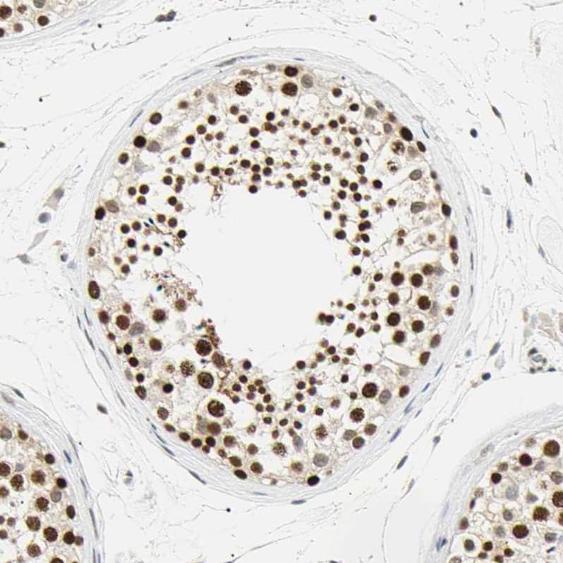 SMARCA5/SNF2H Antibody - BSA Free Immunohistochemistry-Paraffin: SMARCA5/SNF2H Antibody - BSA Free [NBP1-89692]