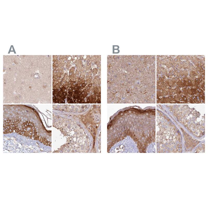 Histidase Antibody - BSA Free Immunohistochemistry-Paraffin: Histidase Antibody [NBP1-89694]