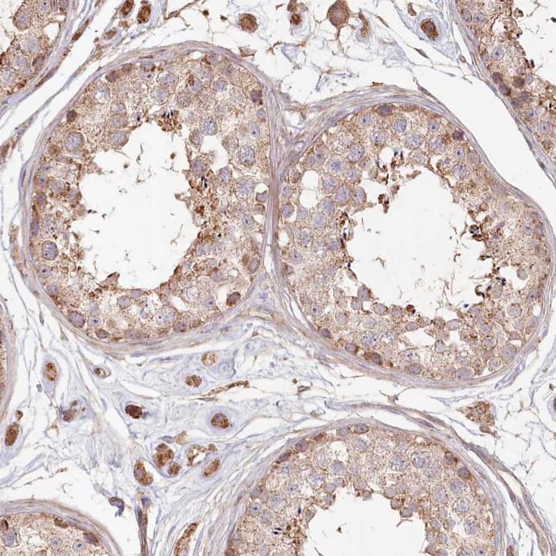 Histidase Antibody - BSA Free Immunohistochemistry-Paraffin: Histidase Antibody - BSA Free [NBP1-89694]
