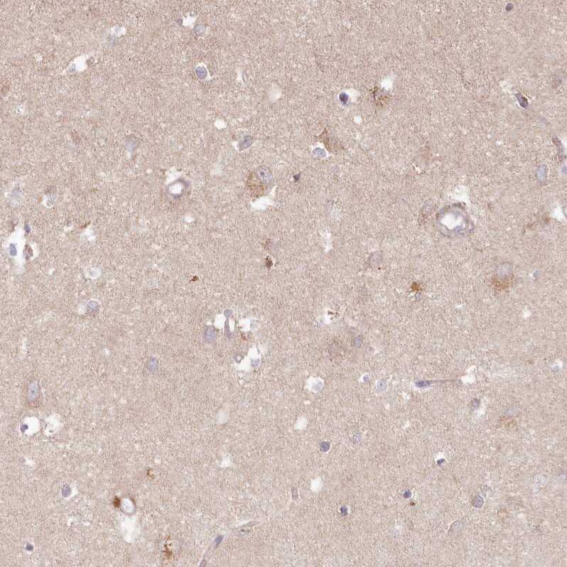 Histidase Antibody - BSA Free Immunohistochemistry-Paraffin: Histidase Antibody - BSA Free [NBP1-89694]