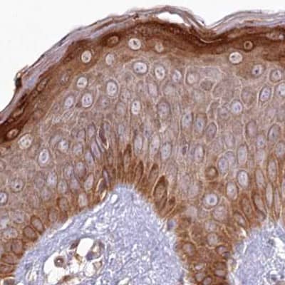Histidase Antibody - BSA Free Immunohistochemistry-Paraffin: Histidase Antibody [NBP1-89695]