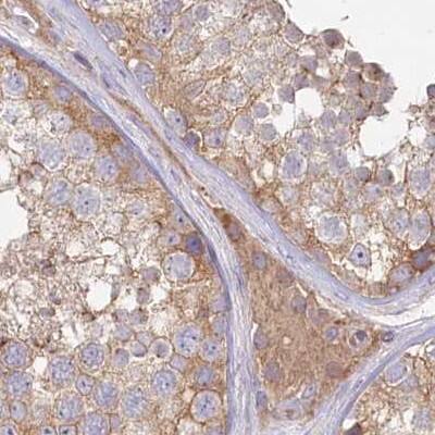 Histidase Antibody - BSA Free Immunohistochemistry-Paraffin: Histidase Antibody [NBP1-89695]