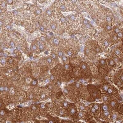 Histidase Antibody - BSA Free Immunohistochemistry-Paraffin: Histidase Antibody [NBP1-89695]