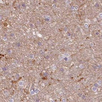 Histidase Antibody - BSA Free Immunohistochemistry-Paraffin: Histidase Antibody [NBP1-89695]