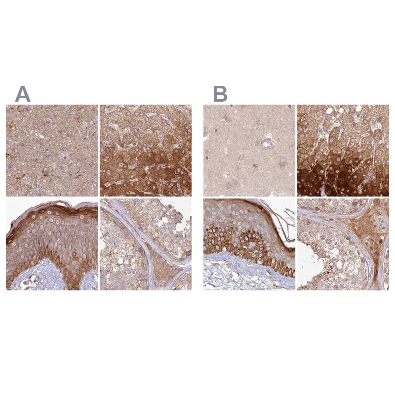 Histidase Antibody - BSA Free Immunohistochemistry-Paraffin: Histidase Antibody [NBP1-89695]