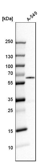 hHR23b Antibody - BSA Free Western Blot: hHR23b Antibody - BSA Free [NBP1-89698]
