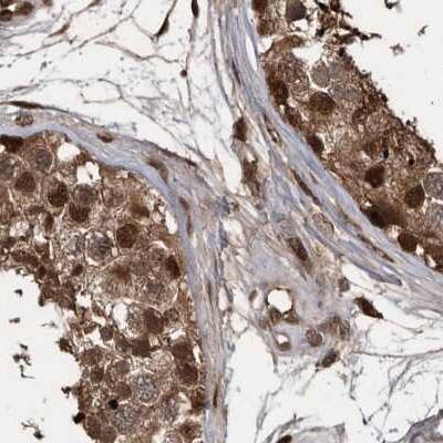 hHR23b Antibody - BSA Free Immunohistochemistry-Paraffin: hHR23b Antibody [NBP1-89699]