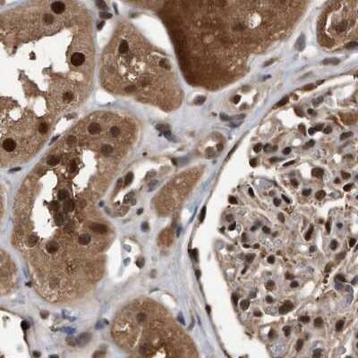 hHR23b Antibody - BSA Free Immunohistochemistry-Paraffin: hHR23b Antibody [NBP1-89699]
