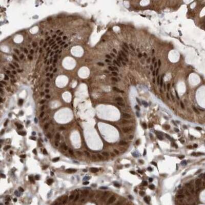 hHR23b Antibody - BSA Free Immunohistochemistry-Paraffin: hHR23b Antibody [NBP1-89699]