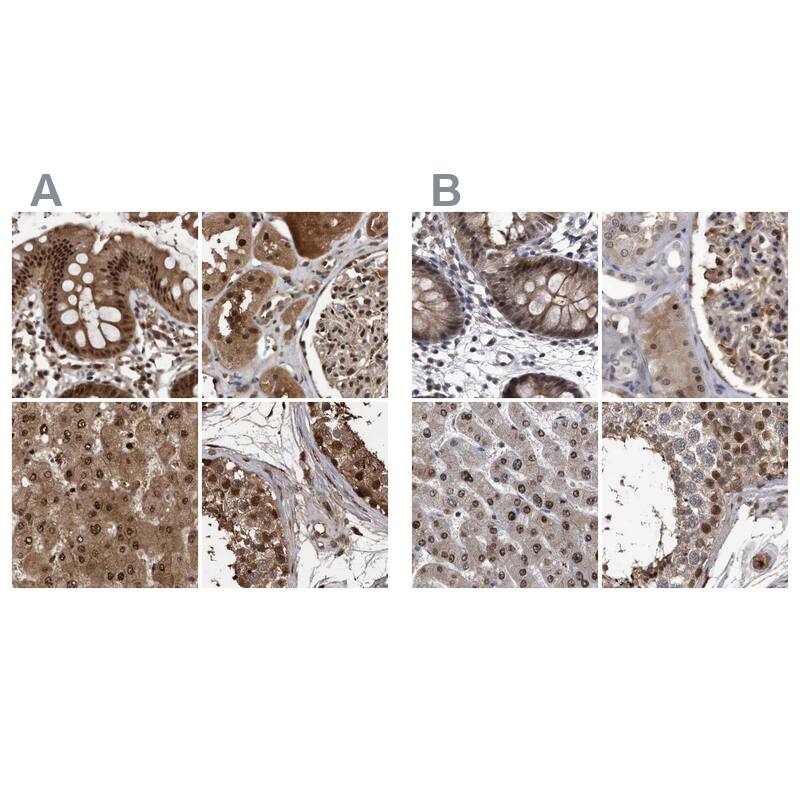 hHR23b Antibody - BSA Free Immunohistochemistry-Paraffin: hHR23b Antibody [NBP1-89699]