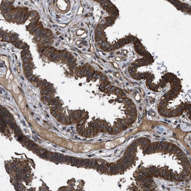 Frizzled-6 Antibody - BSA Free Immunohistochemistry-Paraffin: Frizzled-6 Antibody - BSA Free [NBP1-89702]
