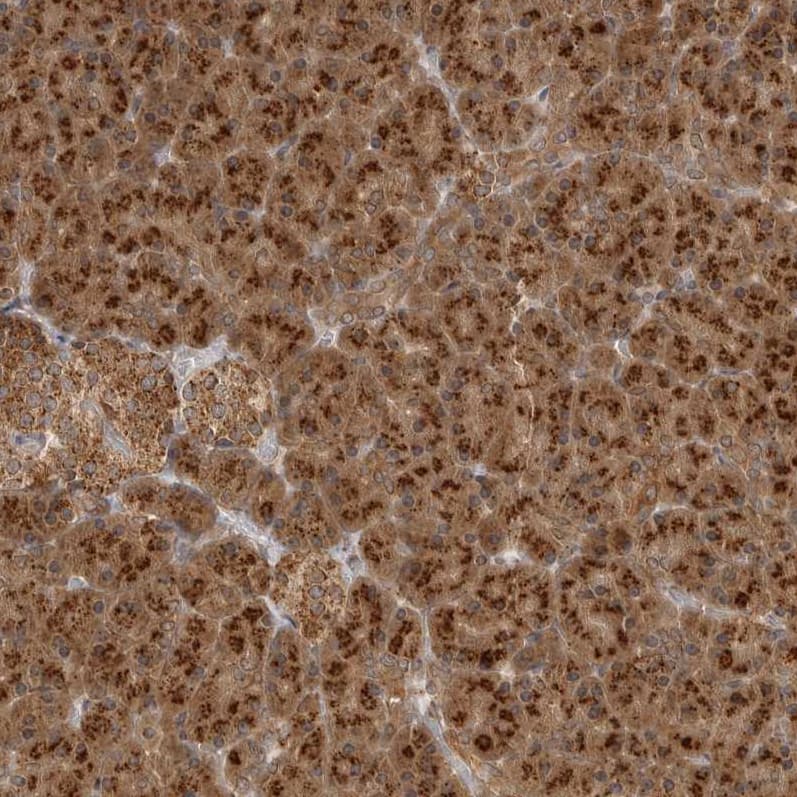 alpha COP I Antibody - BSA Free Immunohistochemistry-Paraffin: alpha COP I Antibody - BSA Free [NBP1-89705]