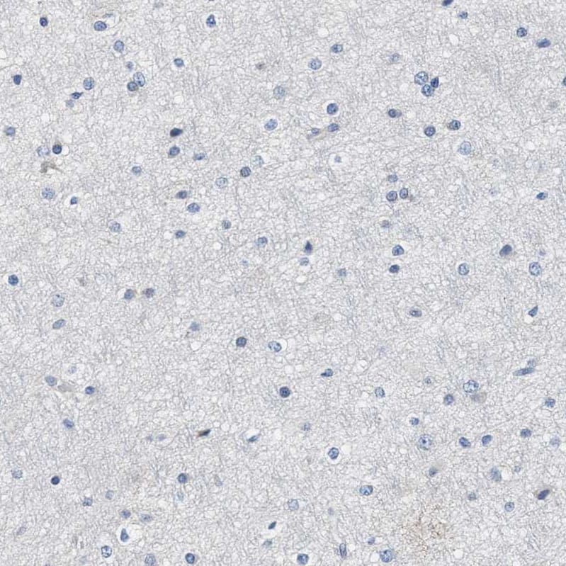 Myosin Heavy Chain 3 Antibody - BSA Free Immunohistochemistry-Paraffin: Myosin Heavy Chain 3 Antibody - BSA Free [NBP1-89707]