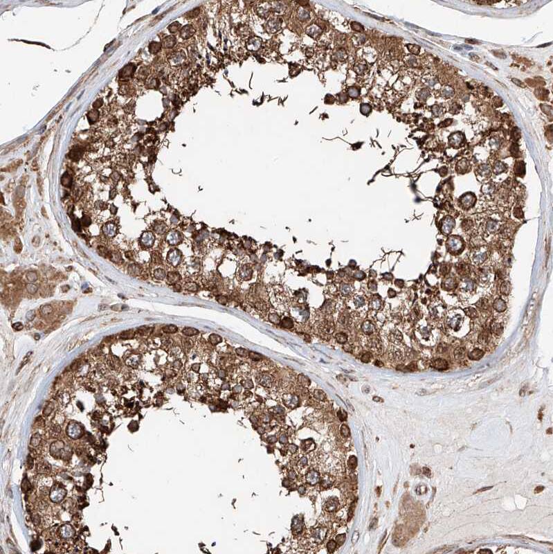 ATPase Antibody - BSA Free Immunohistochemistry-Paraffin: ATPase Antibody - BSA Free [NBP1-89709]
