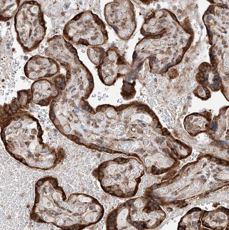 ATPase Antibody - BSA Free Immunohistochemistry-Paraffin: ATPase Antibody - BSA Free [NBP1-89709]