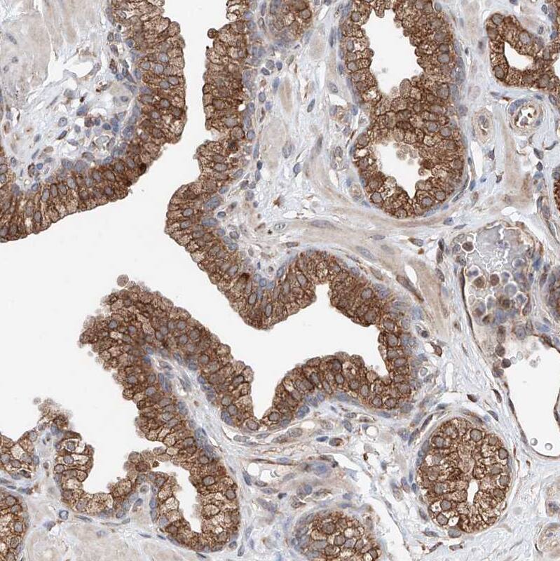 ATPase Antibody - BSA Free Immunohistochemistry-Paraffin: ATPase Antibody - BSA Free [NBP1-89709]