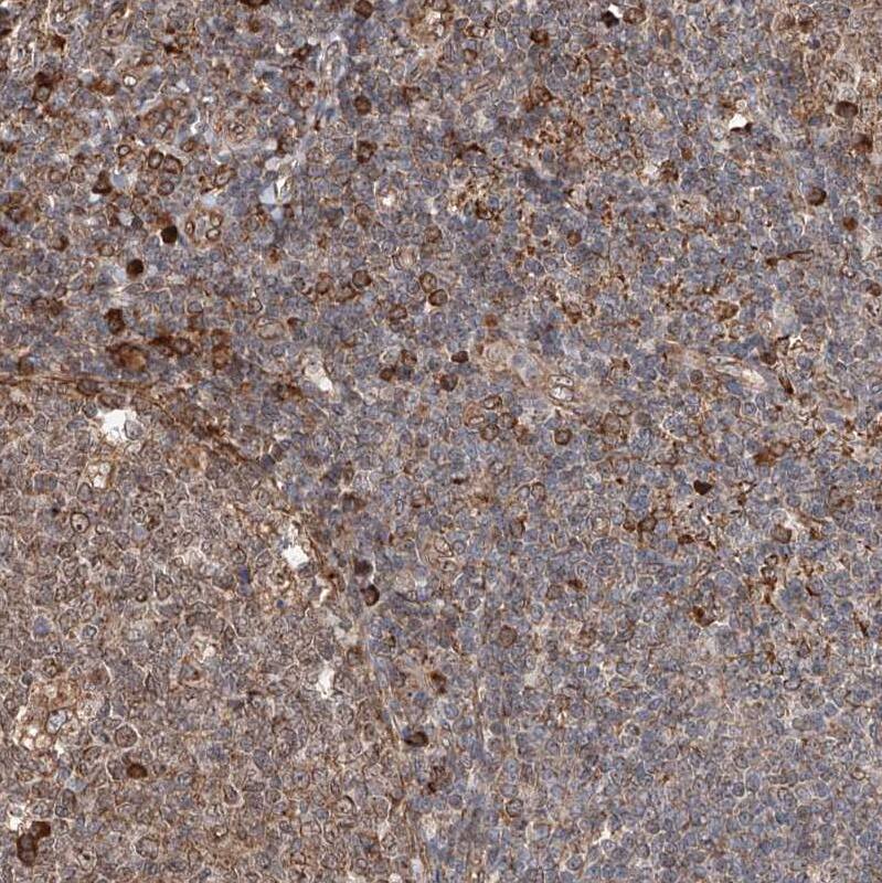 ATPase Antibody - BSA Free Immunohistochemistry-Paraffin: ATPase Antibody - BSA Free [NBP1-89709]