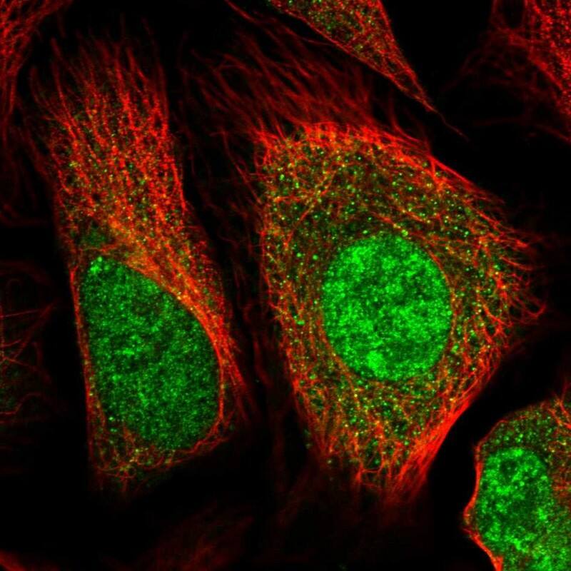 Huntingtin Antibody - BSA Free Immunocytochemistry/ Immunofluorescence: Huntingtin Antibody [NBP1-89710]