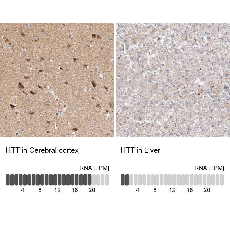 Huntingtin Antibody - BSA Free Immunohistochemistry-Paraffin: Huntingtin Antibody - BSA Free [NBP1-89710]