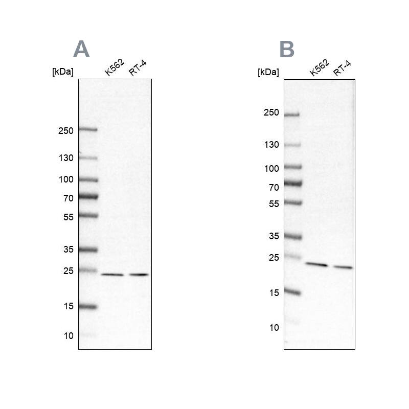 Proteasome beta 1 Antibody - BSA Free Western Blot: Proteasome beta 1 Antibody - BSA Free [NBP1-89714]