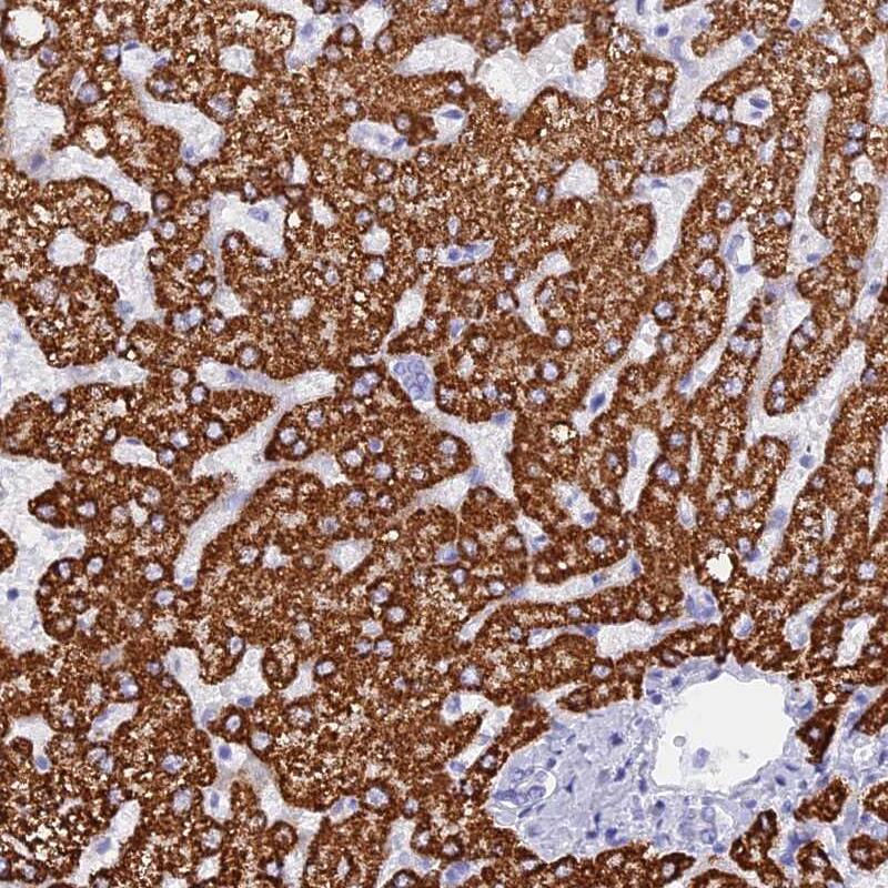 HBLD2 Antibody - BSA Free Immunohistochemistry-Paraffin: HBLD2 Antibody - BSA Free [NBP1-89715]