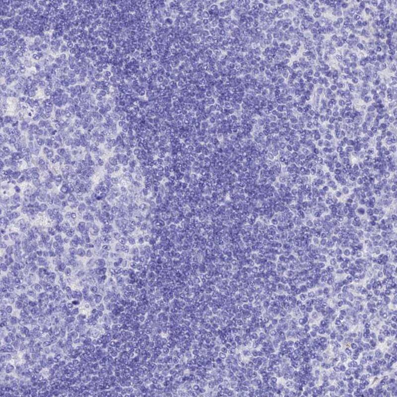 HBLD2 Antibody - BSA Free Immunohistochemistry-Paraffin: HBLD2 Antibody - BSA Free [NBP1-89715]